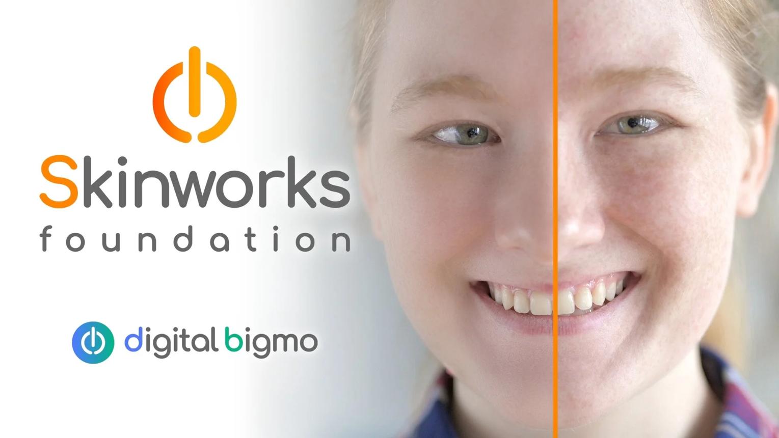 digitalbigmo Skinworks (2)